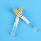 Disposable Yellow Cap PET Vacuum Pro Coagulation Tube 1ml - 10ml