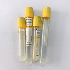 Serum Separating Yellow Cap vacuum blood colletion tube 5ml  Accurate Vacuum Draw Volume