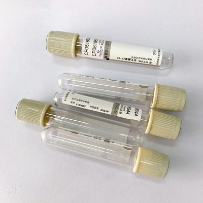 EDTA Na 2 Glucose Blood Tube  Phlebotomy Color Coded  For Sugar Hemolysis