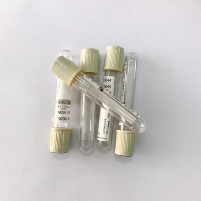 EDTA Na 2 Glucose Blood Tube  Phlebotomy Color Coded  For Sugar Hemolysis