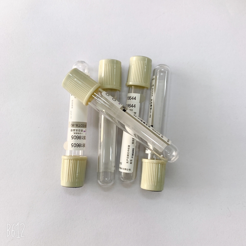 EDTA Na 2 Glucose Blood Tube  Phlebotomy Color Coded  For Sugar Hemolysis